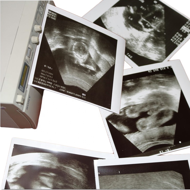 Ультразвуковая термобумага 110S